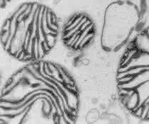 Die Mikroskop-Aufnahme zeigt Mitochondrien, die auch als Kraftwerke der Zellen bekannt sind.