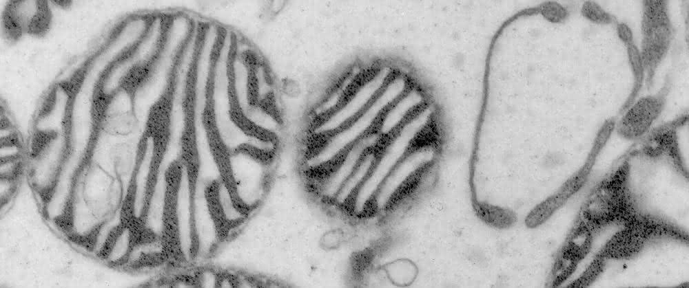 Die Mikroskop-Aufnahme zeigt Mitochondrien, die auch als Kraftwerke der Zellen bekannt sind. Die Mikroskop-Aufnahme zeigt Mitochondrien, die auch als Kraftwerke der Zellen bekannt sind.