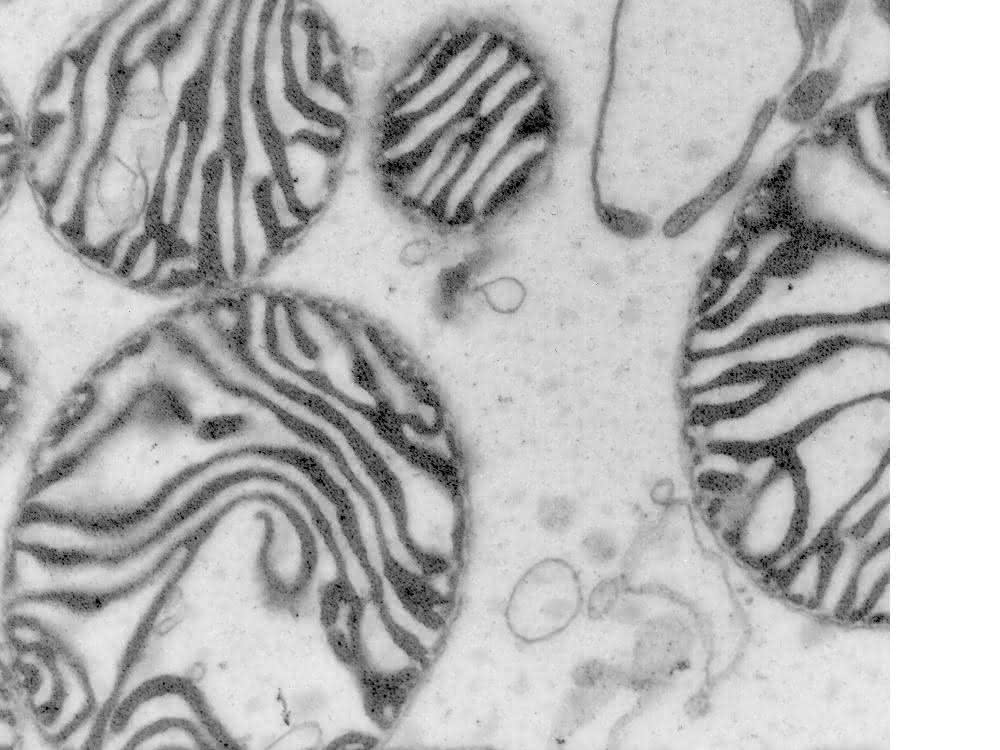 Die Mikroskop-Aufnahme zeigt Mitochondrien, die auch als Kraftwerke der Zellen bekannt sind.
