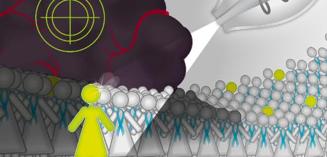 Das Protein CT45 scheint ein Schlüssel zum langfristigen Überleben beim Eierstockkrebs zu sein. Das Protein wurde durch Analyse von Gewebeproben von Krebspatienten dank Massenspektrometrie entdeckt. Das Protein CT45 scheint ein Schlüssel zum langfristigen Überleben beim Eierstockkrebs zu sein. Das Protein wurde durch Analyse von Gewebeproben von Krebspatienten dank Massenspektrometrie entdeckt.