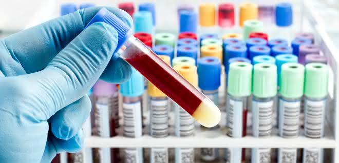Schadstoffaufnahmen aufspüren mit Humanbiomonitoring Schadstoffaufnahmen aufspüren mit Humanbiomonitoring