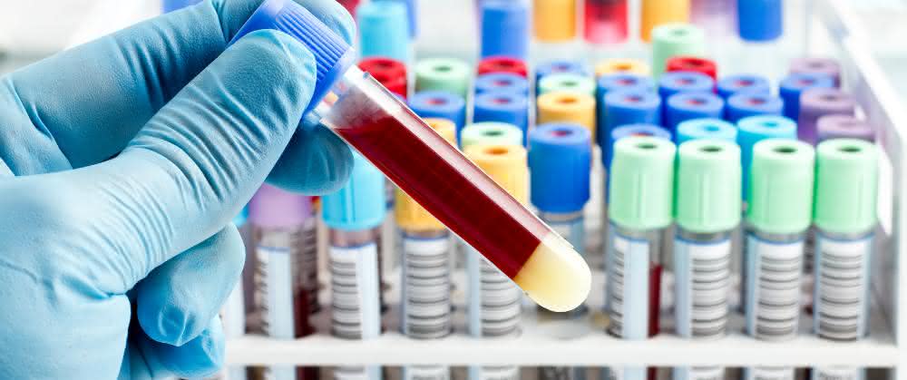 Schadstoffaufnahmen aufspüren mit Humanbiomonitoring Schadstoffaufnahmen aufspüren mit Humanbiomonitoring