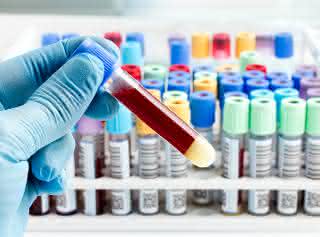 Schadstoffaufnahmen aufspüren mit Humanbiomonitoring