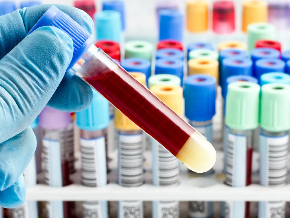 Schadstoffaufnahmen aufspüren mit Humanbiomonitoring