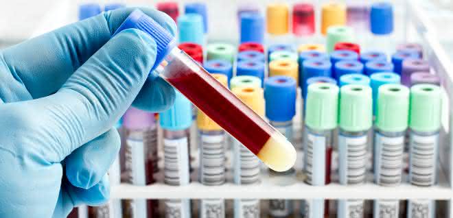Schadstoffaufnahmen aufspüren mit Humanbiomonitoring