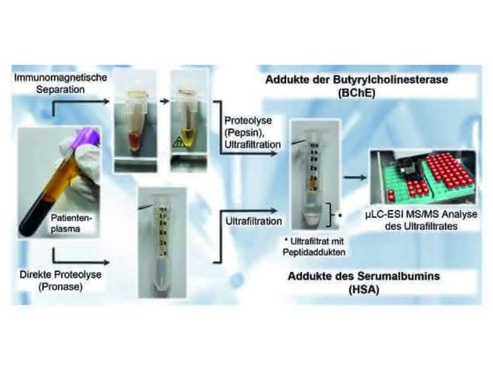 Probenvorbereitung von humanem Serum oder Plasma