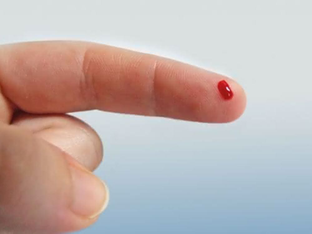 Brustkrebs anhand nur eines Tropfens Blut deutlich früher als bisher diagnostizieren: mit dem Metabolomic-Kit von Biocrates Finger mit Bluttropfen