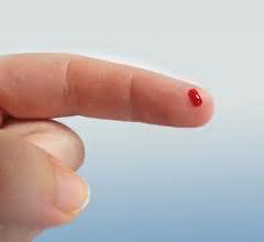 Brustkrebs anhand nur eines Tropfens Blut deutlich früher als bisher diagnostizieren: mit dem Metabolomic-Kit von Biocrates Finger mit Bluttropfen