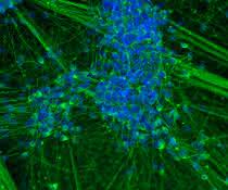 Spontan differenzierte induzierte neurale Stammzellen (iNSC), die sich binnen 20 Tagen zu einem Großteil in junge Neurone weiterentwickelt haben.