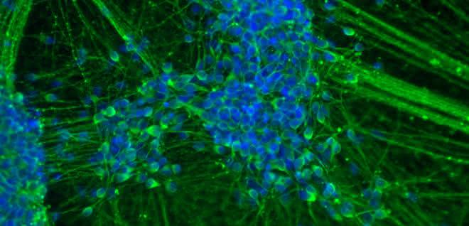 Spontan differenzierte induzierte neurale Stammzellen (iNSC), die sich binnen 20 Tagen zu einem Großteil in junge Neurone weiterentwickelt haben. Spontan differenzierte induzierte neurale Stammzellen (iNSC), die sich binnen 20 Tagen zu einem Großteil in junge Neurone weiterentwickelt haben.