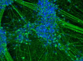 Spontan differenzierte induzierte neurale Stammzellen (iNSC), die sich binnen 20 Tagen zu einem Großteil in junge Neurone weiterentwickelt haben. Spontan differenzierte induzierte neurale Stammzellen (iNSC), die sich binnen 20 Tagen zu einem Großteil in junge Neurone weiterentwickelt haben.