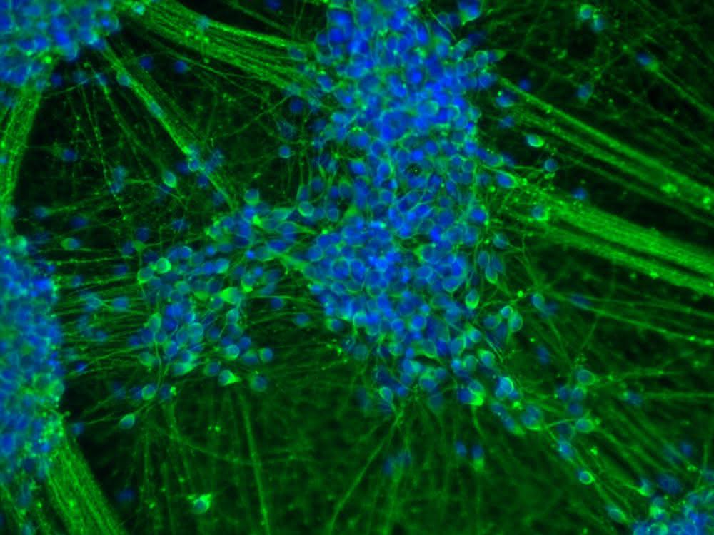 Spontan differenzierte induzierte neurale Stammzellen (iNSC), die sich binnen 20 Tagen zu einem Großteil in junge Neurone weiterentwickelt haben.