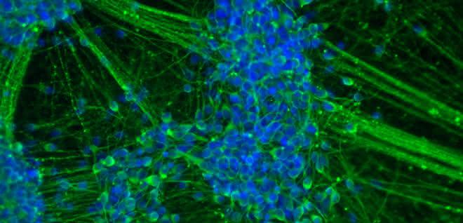 Spontan differenzierte induzierte neurale Stammzellen (iNSC), die sich binnen 20 Tagen zu einem Großteil in junge Neurone weiterentwickelt haben.