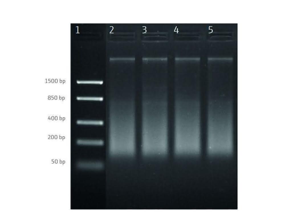 Bild 1: Agarose-Gel-Elektrophorese von extrahierter DNA aus gefrorenen Garnelenproben. Reihe 1: DNA-Leiter; Reihe 2 – 5: Proben 1 – 4.