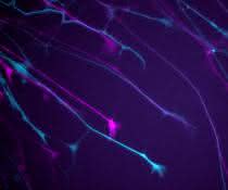 Neuritenwachstumsmessung von GFP-exprimierenden Neuronen. Der erste und letzte Zeitpunkt (0 min, 50 min) sind in Magenta und Cyan gezeigt.