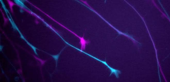 Neuritenwachstumsmessung von GFP-exprimierenden Neuronen. Der erste und letzte Zeitpunkt (0 min, 50 min) sind in Magenta und Cyan gezeigt.