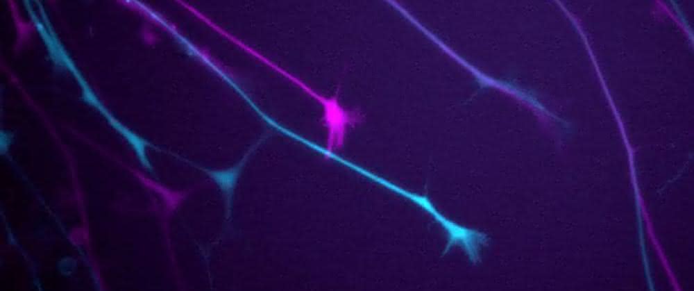 Neuritenwachstumsmessung von GFP-exprimierenden Neuronen. Der erste und letzte Zeitpunkt (0 min, 50 min) sind in Magenta und Cyan gezeigt. Neuritenwachstumsmessung von GFP-exprimierenden Neuronen. Der erste und letzte Zeitpunkt (0 min, 50 min) sind in Magenta und Cyan gezeigt.