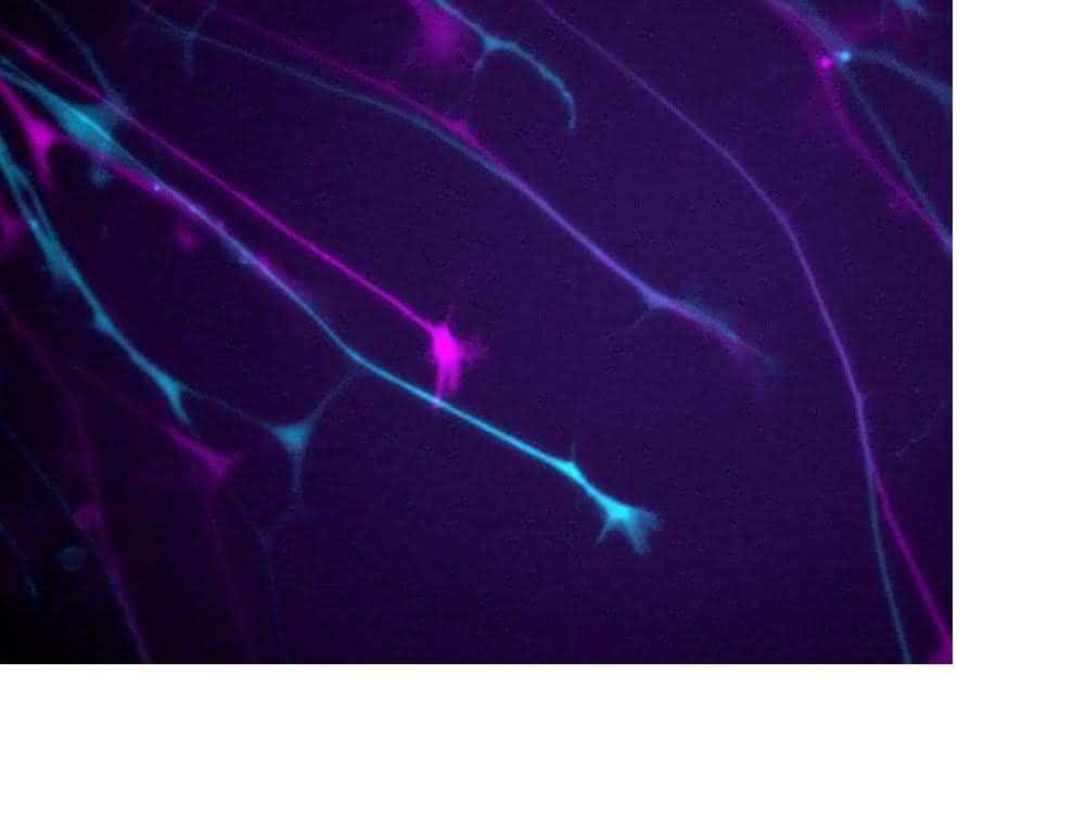 Neuritenwachstumsmessung von GFP-exprimierenden Neuronen. Der erste und letzte Zeitpunkt (0 min, 50 min) sind in Magenta und Cyan gezeigt.