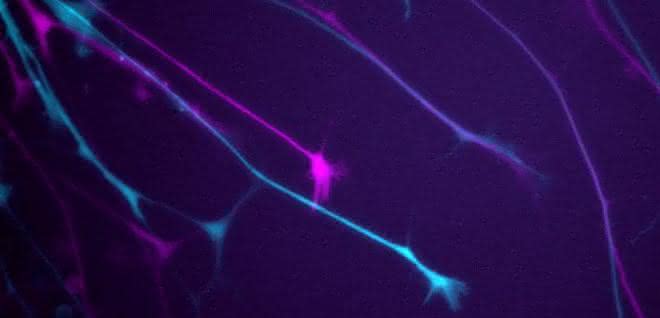 Neuritenwachstumsmessung von GFP-exprimierenden Neuronen. Der erste und letzte Zeitpunkt (0 min, 50 min) sind in Magenta und Cyan gezeigt. Neuritenwachstumsmessung von GFP-exprimierenden Neuronen. Der erste und letzte Zeitpunkt (0 min, 50 min) sind in Magenta und Cyan gezeigt.