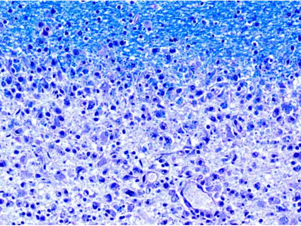 Gewebeschnitt mit Anfärbung des Myelins