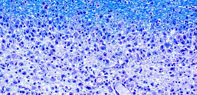 Gewebeschnitt mit Anfärbung des Myelins