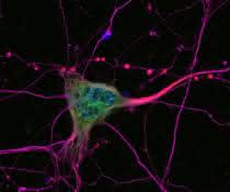 Mikroskopische Aufnahme von Neuronen
