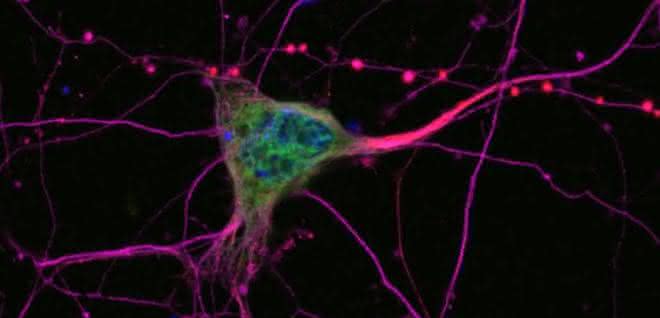 Bei der ALS sterben Nervenzellen ab, die für die Muskelsteuerung verantwortlich sind (Motoneurone). Mikroskopische Aufnahme von Neuronen