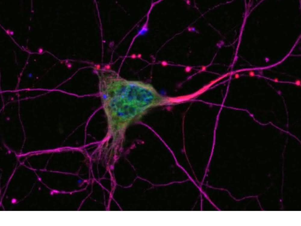 Mikroskopische Aufnahme von Neuronen