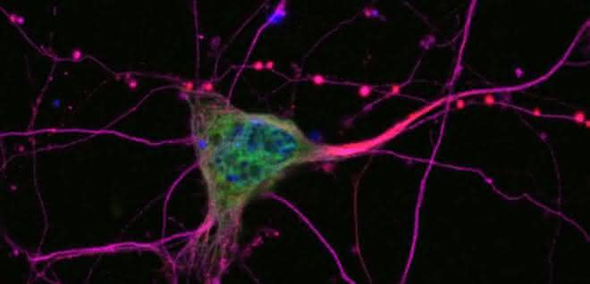 Bei der ALS sterben Nervenzellen ab, die für die Muskelsteuerung verantwortlich sind (Motoneurone). Mikroskopische Aufnahme von Neuronen