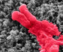Antibiotikabeschichtung lysiert Bakterium (E.coli). Antibiotikabeschichtung lysiert Bakterium (E.coli).