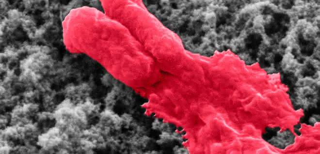 Antibiotikabeschichtung lysiert Bakterium (E.coli). Antibiotikabeschichtung lysiert Bakterium (E.coli).
