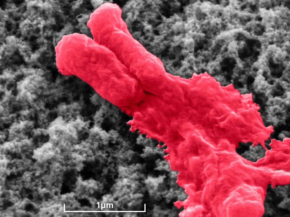 Antibiotikabeschichtung lysiert Bakterium (E.coli).