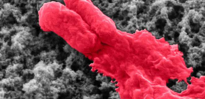 Antibiotikabeschichtung lysiert Bakterium (E.coli). Antibiotikabeschichtung lysiert Bakterium (E.coli).