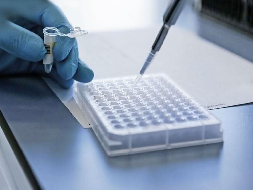 Pipettieren auf Mikrotiterplatte Pipettieren auf Mikrotiterplatte