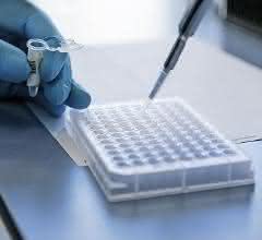 Pipettieren auf Mikrotiterplatte