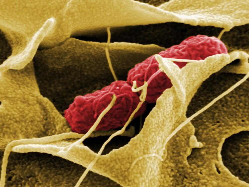 Die Wirtszelle umschließt eine Salmonelle mit Ausstülpungen ihrer Membran und ermöglicht ihr so erst die Infektion.
