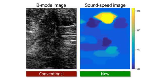 Ultraschallbilder alters und neues Verfahren im Vergleich