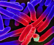 Elektronenmikroskopische Aufnahme von kultivierten Escherichia coli auf einem Objektträger, nachträglich koloriert.