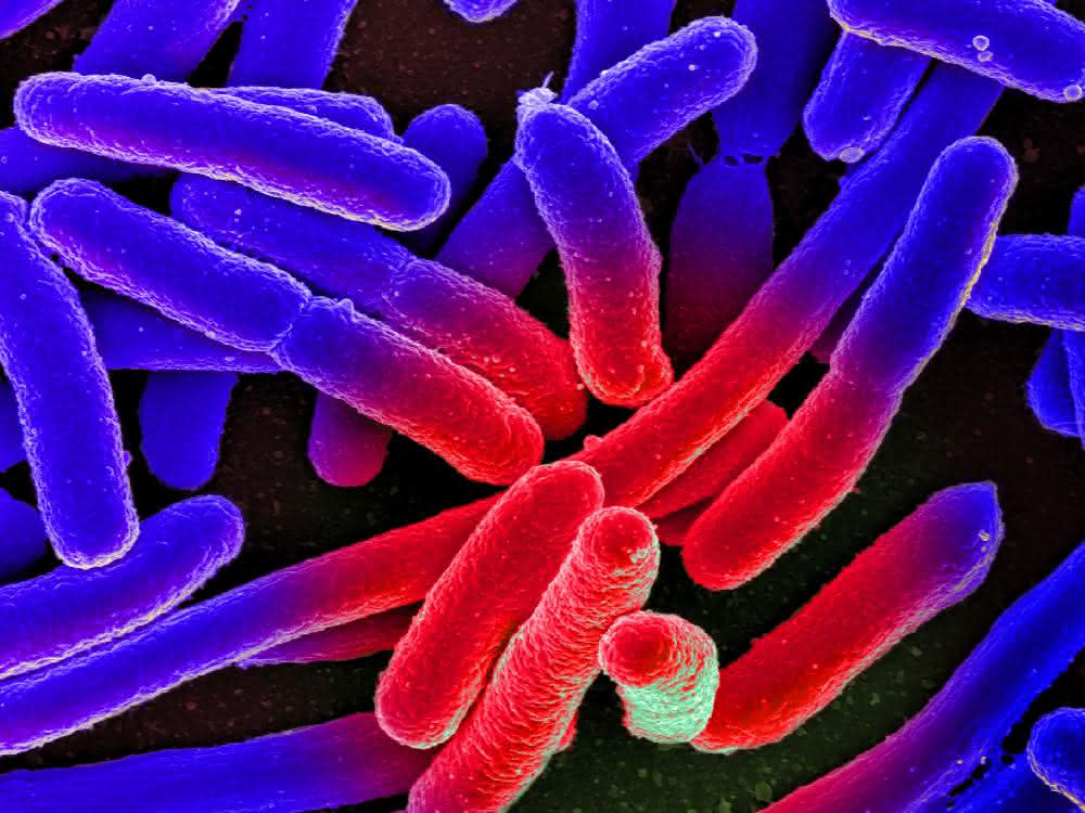 Elektronenmikroskopische Aufnahme von kultivierten Escherichia coli auf einem Objektträger, nachträglich koloriert. Elektronenmikroskopische Aufnahme von kultivierten Escherichia coli auf einem Objektträger, nachträglich koloriert.