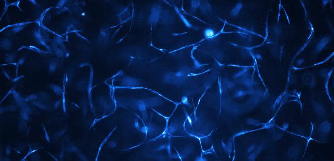 Im Biochip gezüchtete menschliche Gefäßsysteme. Im Biochip gezüchtete menschliche Gefäßsysteme.