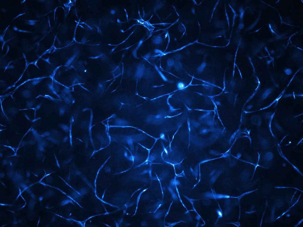 Im Biochip gezüchtete menschliche Gefäßsysteme.