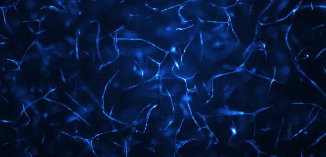 Im Biochip gezüchtete menschliche Gefäßsysteme.