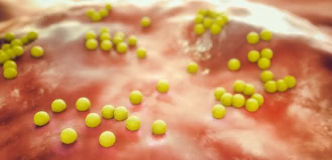 MRSA-Bakterien (Staphylococcus aureus) machen sich mit Hilfe eines Proteins unsichtbar für das Immunsystem.