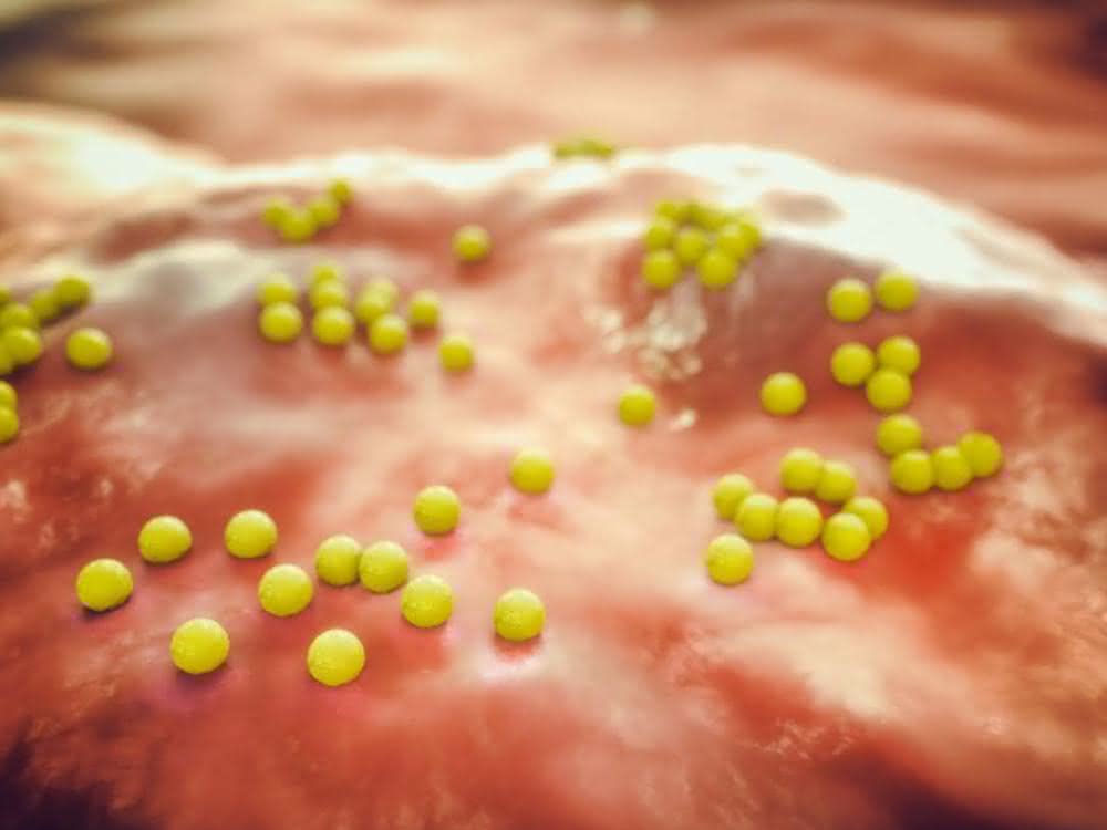 MRSA-Bakterien (Staphylococcus aureus) machen sich mit Hilfe eines Proteins unsichtbar für das Immunsystem.