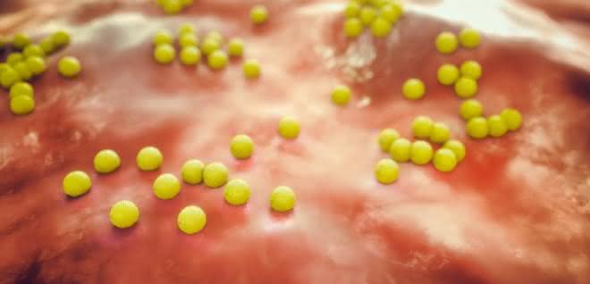 MRSA-Bakterien (Staphylococcus aureus) machen sich mit Hilfe eines Proteins unsichtbar für das Immunsystem.