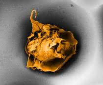 Makrophage in einer Pore mit 20 Mikrometer Durchmesser (Elektronenmikroskopische Aufnahme). Makrophage in einer Pore mit 20 Mikrometer Durchmesser (Elektronenmikroskopische Aufnahme).