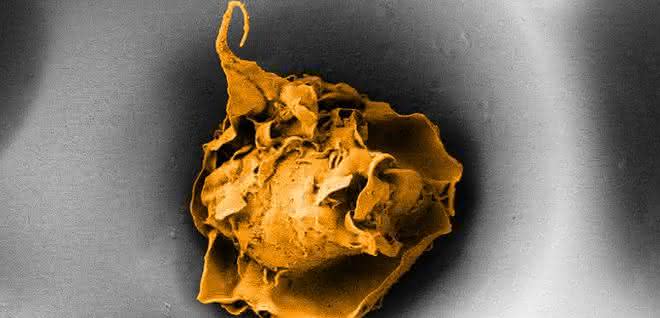 Makrophage in einer Pore mit 20 Mikrometer Durchmesser (Elektronenmikroskopische Aufnahme).