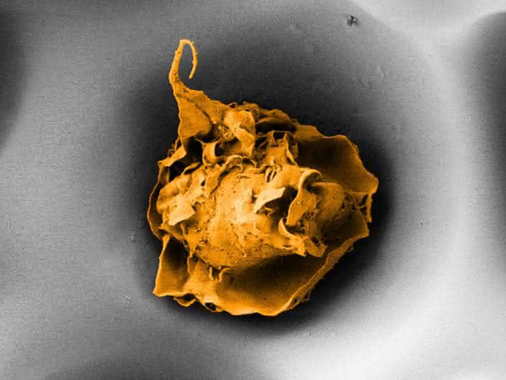 Makrophage in einer Pore mit 20 Mikrometer Durchmesser (Elektronenmikroskopische Aufnahme). Makrophage in einer Pore mit 20 Mikrometer Durchmesser (Elektronenmikroskopische Aufnahme).