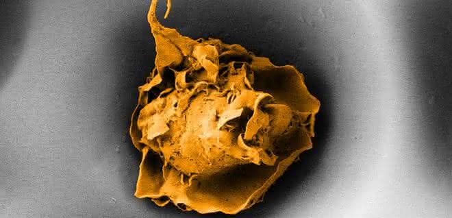 Makrophage in einer Pore mit 20 Mikrometer Durchmesser (Elektronenmikroskopische Aufnahme). Makrophage in einer Pore mit 20 Mikrometer Durchmesser (Elektronenmikroskopische Aufnahme).
