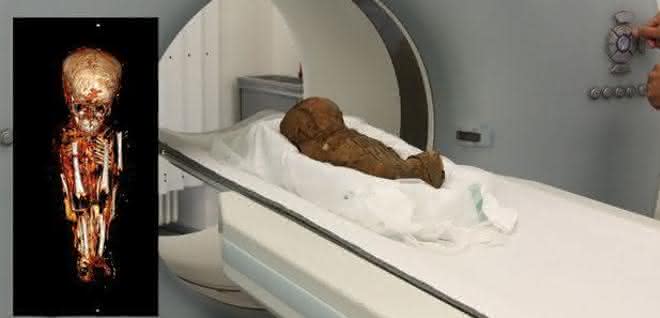 ägyptische Kindermumie aus dem Naturhistorischen Museum Basel